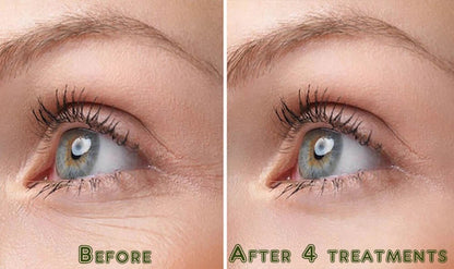 Pure Hyaluronic Acid Anti-Aging Serum