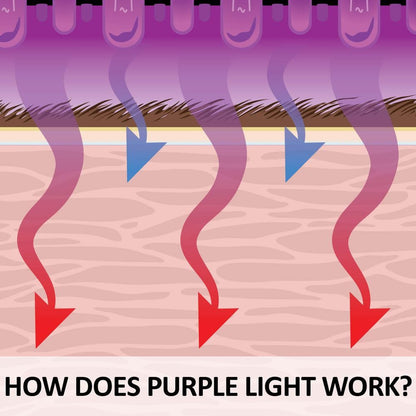 Schneiders EquiCare LED Purple Light Horse Kit | Dual-Wavelength Red & Blue LED System for Equine Wellness Support | Cordless & Rechargeable | Includes Wraps & Bell Boots